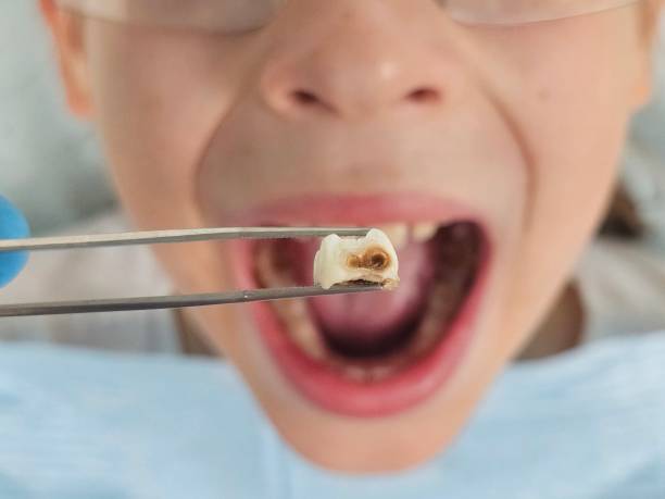 Best Emergency Dental Services Near Me  in Cherry Hill, VA